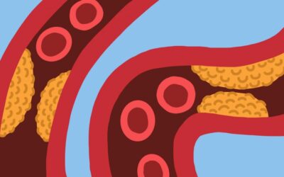 Hoge cholesterol als gevolg van hyperventilatie